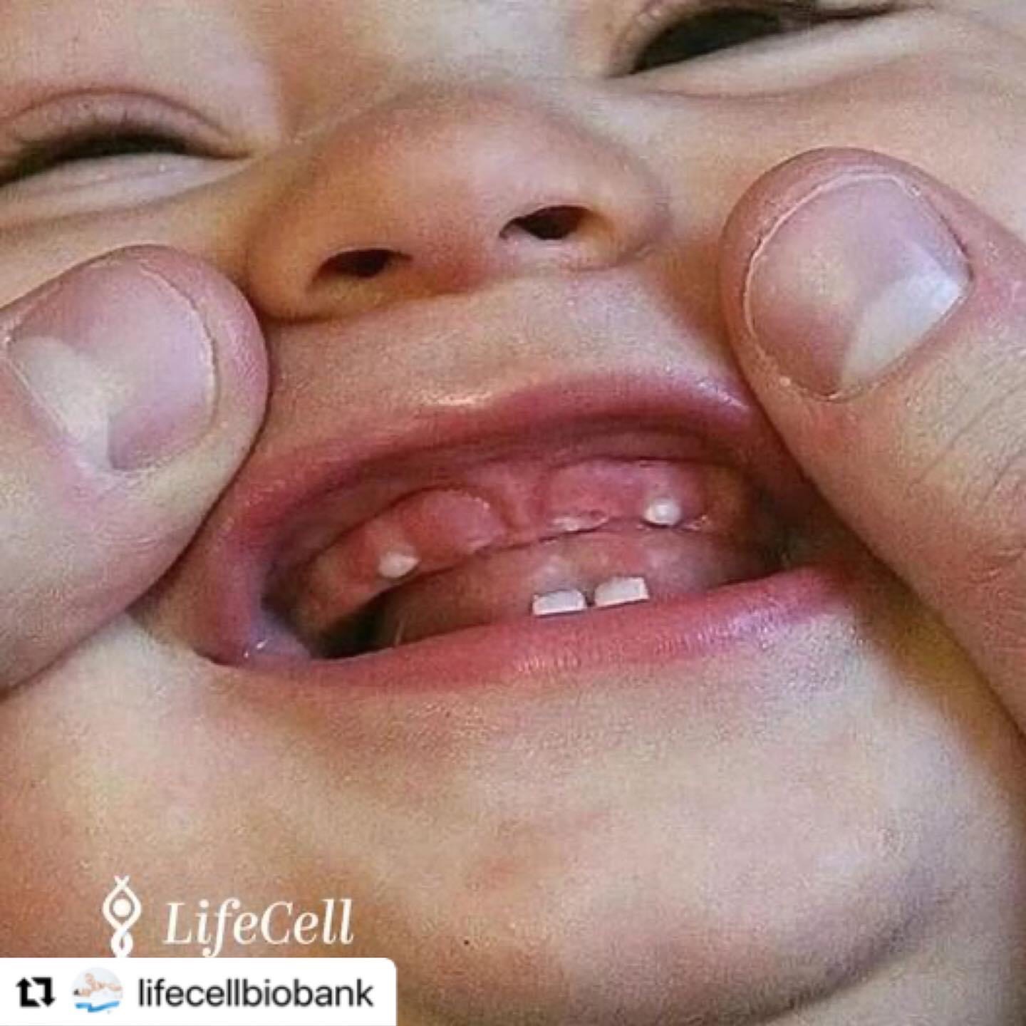 Mos i hidhni dhëmbët e qumështit, ata kanë qeliza staminale jetëshpëtuese.